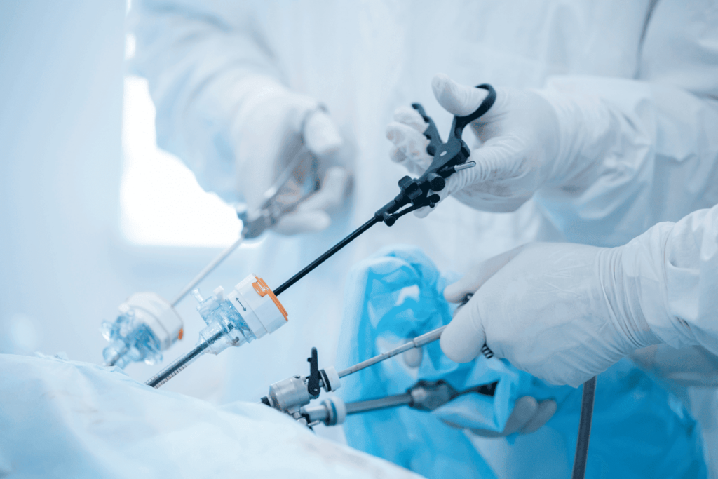 Лапароскопічне видалення жовчного міхура